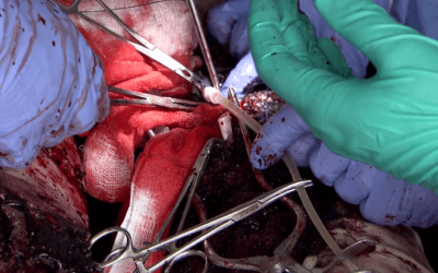 Haemostasis and Arterial Shunting